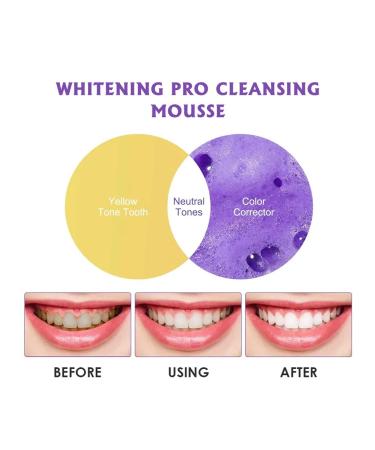 Eelhoe teeth whitening tooth cleansing of mousse stains for uh ... - Buy Online on GoSupps.com