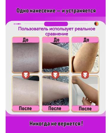 Cream from goose skin for body 100 g - Buy Online on GoSupps.com