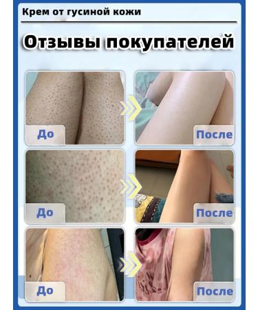 Cream from goose skin for body 100 g - Buy Online on GoSupps.com