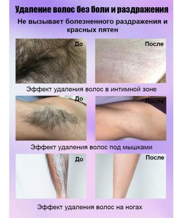LYDIMOON Hair removal cream sensitive skin - Buy Online on GoSupps.com