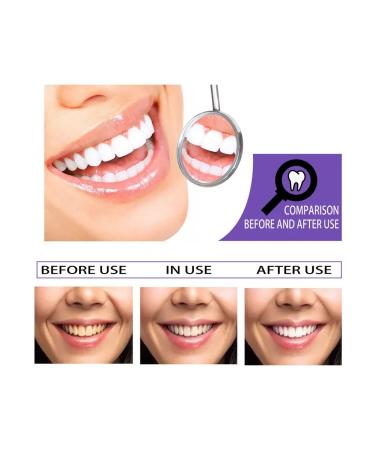Non -invasive purple bleaching toothpaste - Buy Online on GoSupps.com