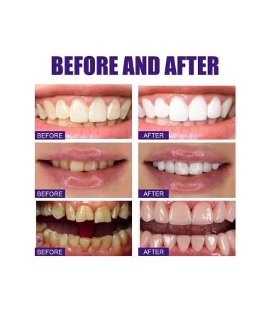 Jaysuing purple v34 tooth whitening - Buy Online on GoSupps.com