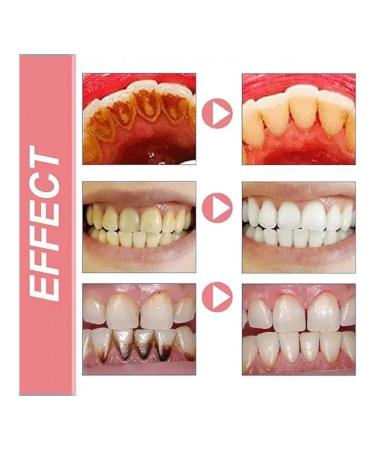 Toothpaste A CC Fresh Probiotic Whitening SP8 - Buy Online on GoSupps.com