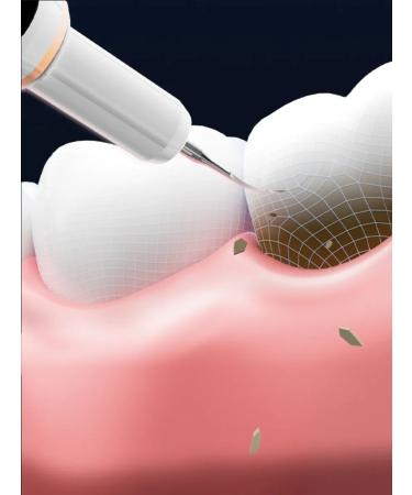 OralB Irrigator with ultrasound LED display Portable - Buy Online on GoSupps.com