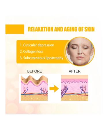 Jaysuing patches for nasolabial folds from edema hydrogel - Buy Online on GoSupps.com