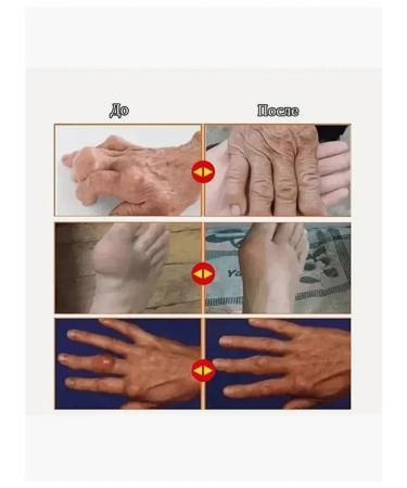 An ointment anesthetic from gout on the legs 110r - Buy Online on GoSupps.com