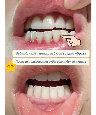 Whitening pasta with niacinamide anti -inflammatory - Buy Online on GoSupps.com