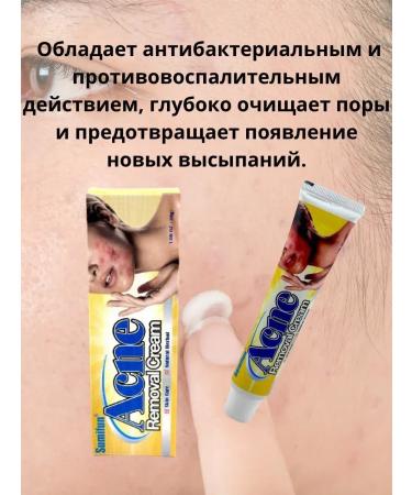 Natka intensive Acne cream for sensitive skin - Buy Online on GoSupps.com