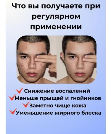 Ailuu Acne cream and oily shine - Buy Online on GoSupps.com