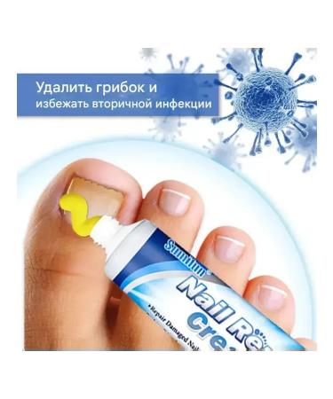 MaxWish 09 Cream ointment from the fungus on the legs of onychomycosis 3 pcs - Buy Online on GoSupps.com