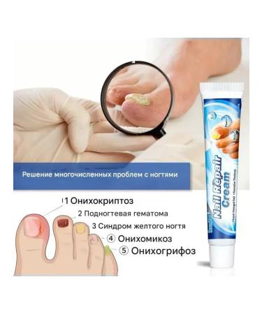 MaxWish 09 Cream ointment from the fungus on the legs of onychomycosis 5 pcs - Buy Online on GoSupps.com