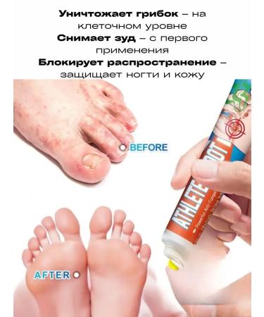 Dona7 Feet cream from fungus and smell - Buy Online on GoSupps.com