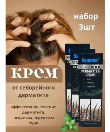 alma2 Cream from seborrheic dermatitis and dandruff Effective 3pcs