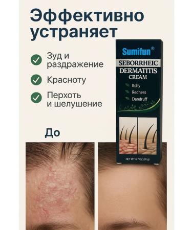 kan3 Cream against seborrheic dermatitis itching and irritation - Buy Online on GoSupps.com