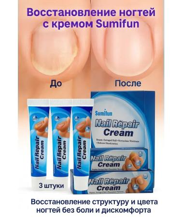 TRADE Nail restoration cream 3 pieces