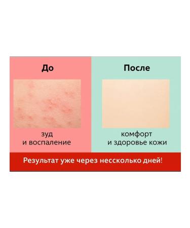 ami77 Cream from psoriasis eczema and skin rashes 5pcs - Buy Online on GoSupps.com