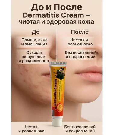 Kirunya Intensive Herbal ointment from itching skin acne and acne - Buy Online on GoSupps.com