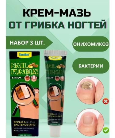 RIVON Cream from nail fungus Therapeutic Chinese