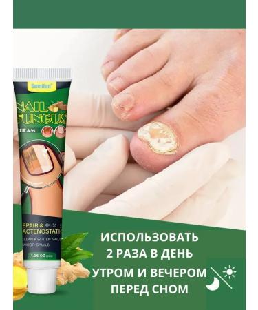 RIVON Cream from nail fungus Therapeutic Chinese - Buy Online on GoSupps.com