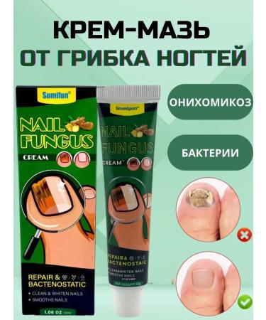 RIVON Ointment from nail fungus Chiri Chinese