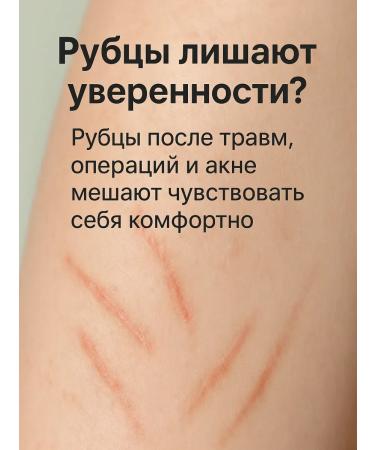 COME Cream from scars and scars - Buy Online on GoSupps.com