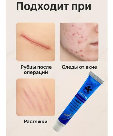 COME Cream from scars and scars - Buy Online on GoSupps.com