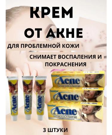 LATIBEAUTYFUL Acne agent