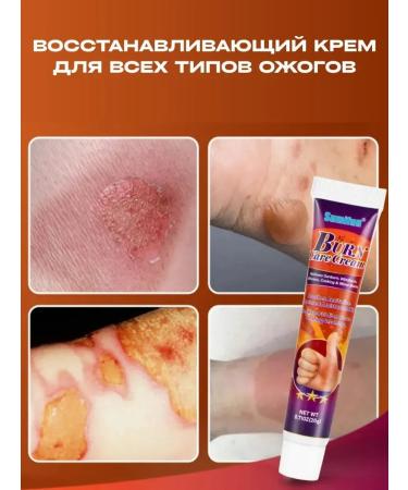Dona7 Cream for dryness and peeling of the skin after a burn - Buy Online on GoSupps.com
