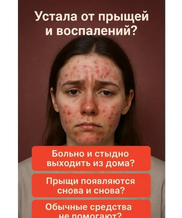 Kirunya Acne cream - Buy Online on GoSupps.com