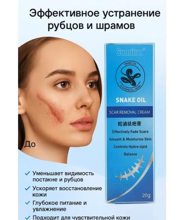 Kirunya Intensive Cream against scars and scars