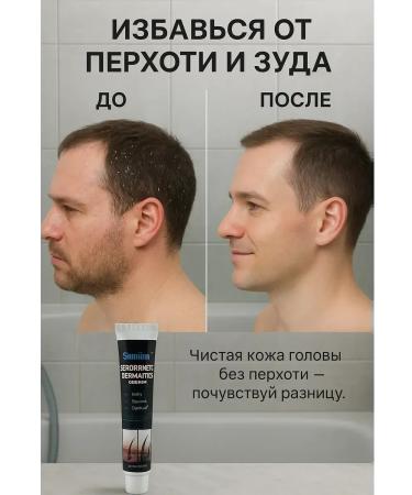 Kirunya Intensive Antibacterial cream from seborrheic dermatitis - Buy Online on GoSupps.com