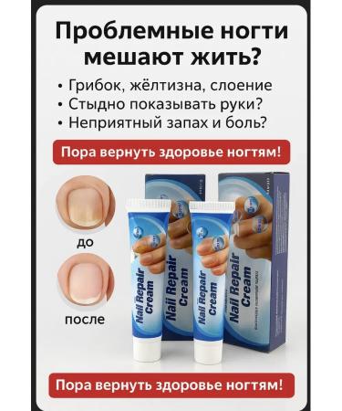 MK77 Cream against nail fungus. Set 5 pcs - Buy Online on GoSupps.com