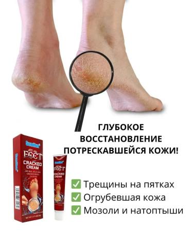 Dona7 Cream for dry and coarse leather legs - Buy Online on GoSupps.com