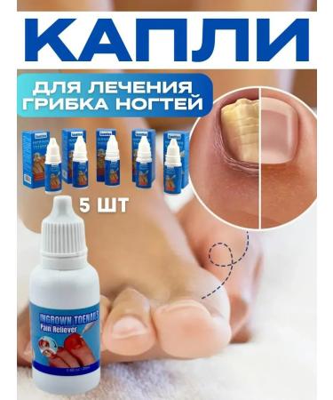 Dona7 Ingrown toenail remedy