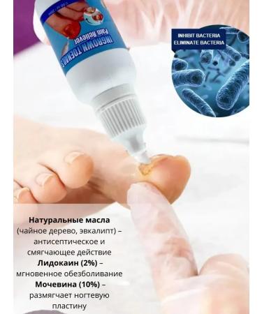 Dona7 Ingrown toenail remedy - Buy Online on GoSupps.com