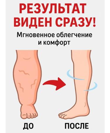 COME 3 Cream for leg swelling - Buy Online on GoSupps.com