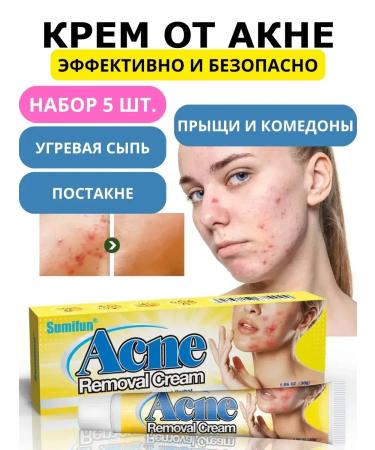 RIVON Acne cream and acne on the face