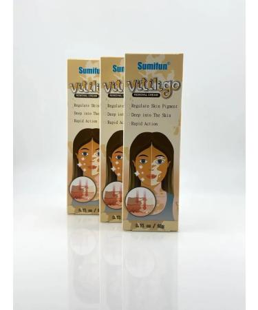 kaniali Vitiligo cream for pigmented white stains of the skin