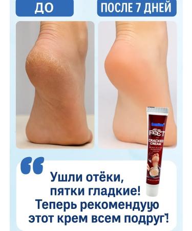 Kirunya Cream from cracks on heels corns and dry legs - Buy Online on GoSupps.com