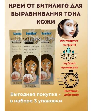 Ailuu Vitiligo cream and age spots on the skin