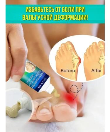 Dona7 Cream for valgus deformation - Buy Online on GoSupps.com