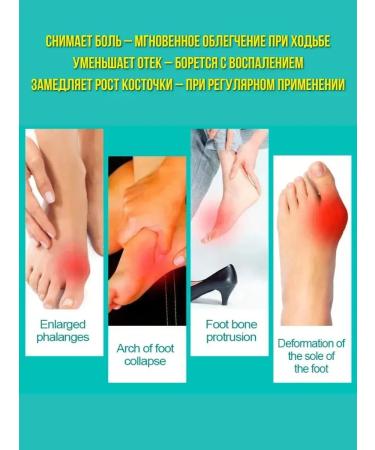 Dona7 Cream for valgus deformation - Buy Online on GoSupps.com