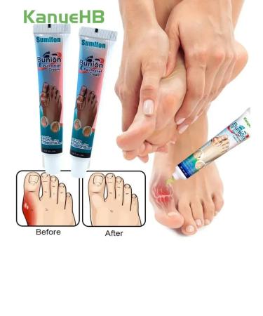 Dona7 Cream for valgus deformation - Buy Online on GoSupps.com