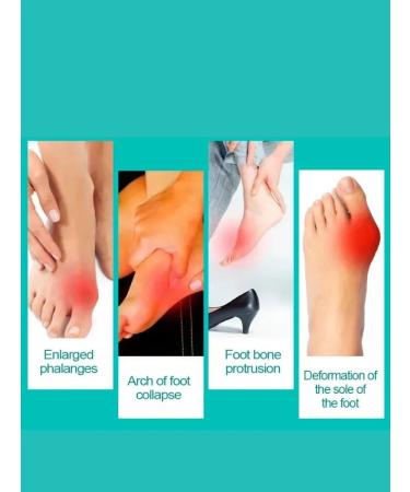 Dona7 Ointment from the bump on the finger - Buy Online on GoSupps.com