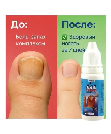 ALIM16 Effective remedy for nail fungus 3 pcs - Buy Online on GoSupps.com