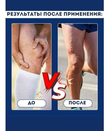 KazBrand Anesthetic cream for knees and legs - Buy Online on GoSupps.com