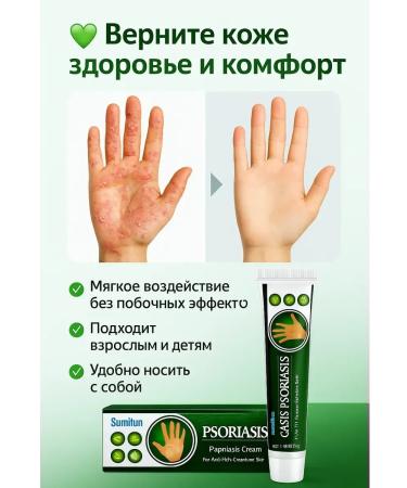 mubi123 Cream ointment from eczema and psoriasis