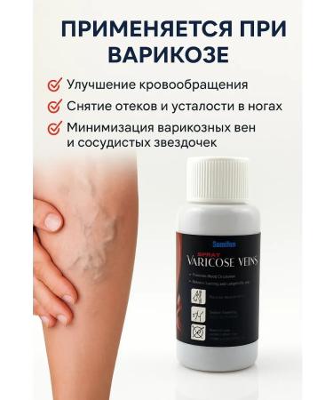CHYNARA Varicose vein remedy - Buy Online on GoSupps.com