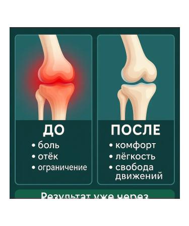 ami77 Anesthetic cream for muscles ligaments and joints 3pcs - Buy Online on GoSupps.com