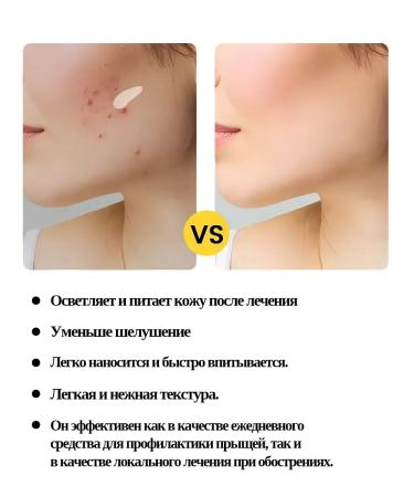 Barynch Gruttered cream on the face - Buy Online on GoSupps.com